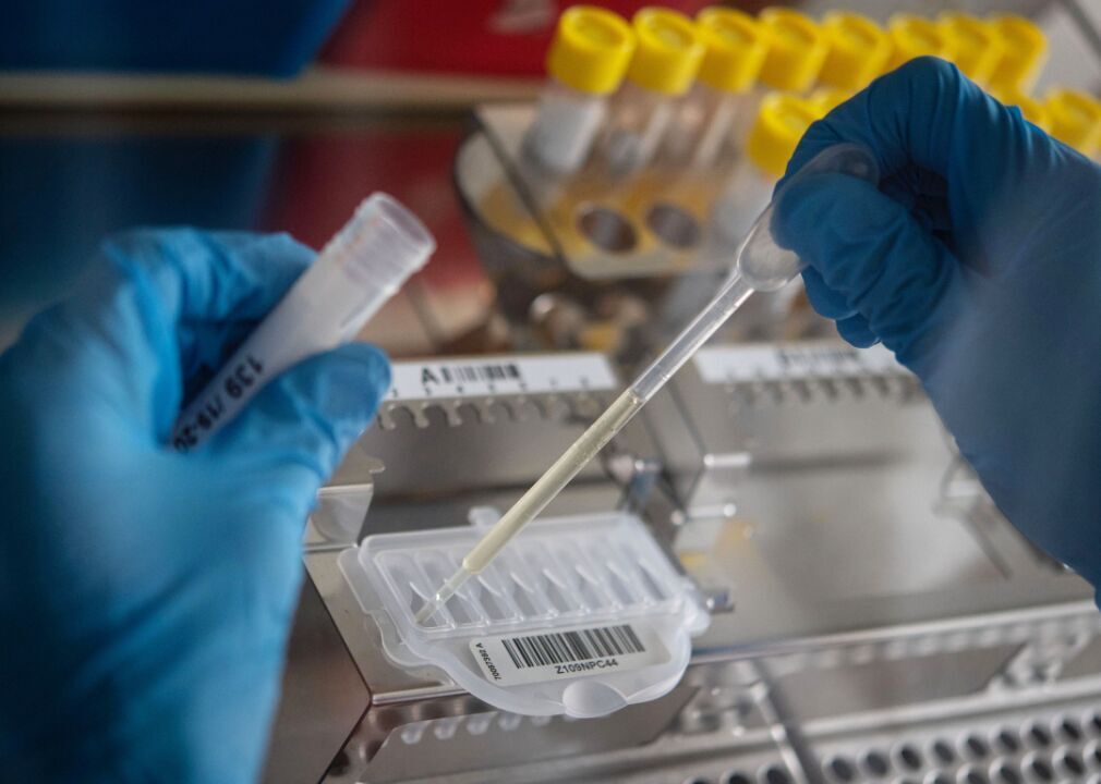 Why to understand SARS-CoV-2